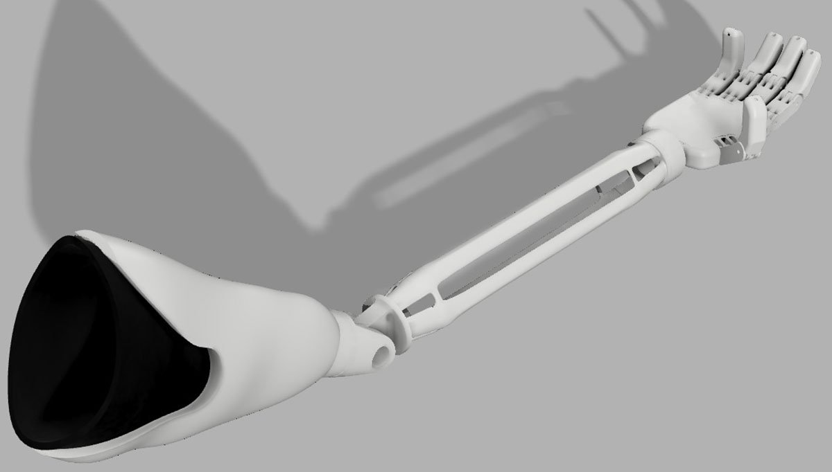 Tesis de grado permitirá imprimir prótesis personalizada para niño que nació sin brazos